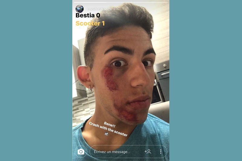 Bastianini 0 – Patinete 1