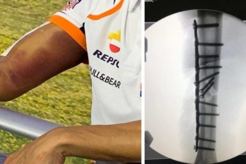 MotoGP : les frères Marquez ont récolté près de 65 000 euros pour la Croix Rouge
