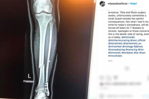Mika Kallio s'est sérieusement blessé ...