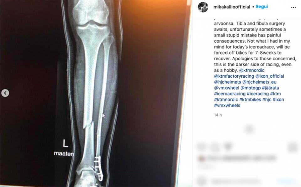 MotoGP [Video]: KTM will have to do without Mika Kallio with a broken leg