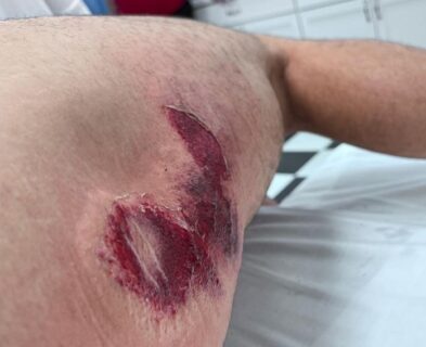 MotoAmerica Danilo Petrucci se souviendra de sa chute à 280 km/h : "je suis resté par terre pendant plus de 2 minutes sans que personne ne m'aide"