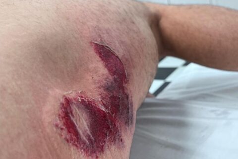 MotoAmerica Danilo Petrucci se souviendra de sa chute à 280 km/h : "je suis resté par terre pendant plus de 2 minutes sans que personne ne m'aide"