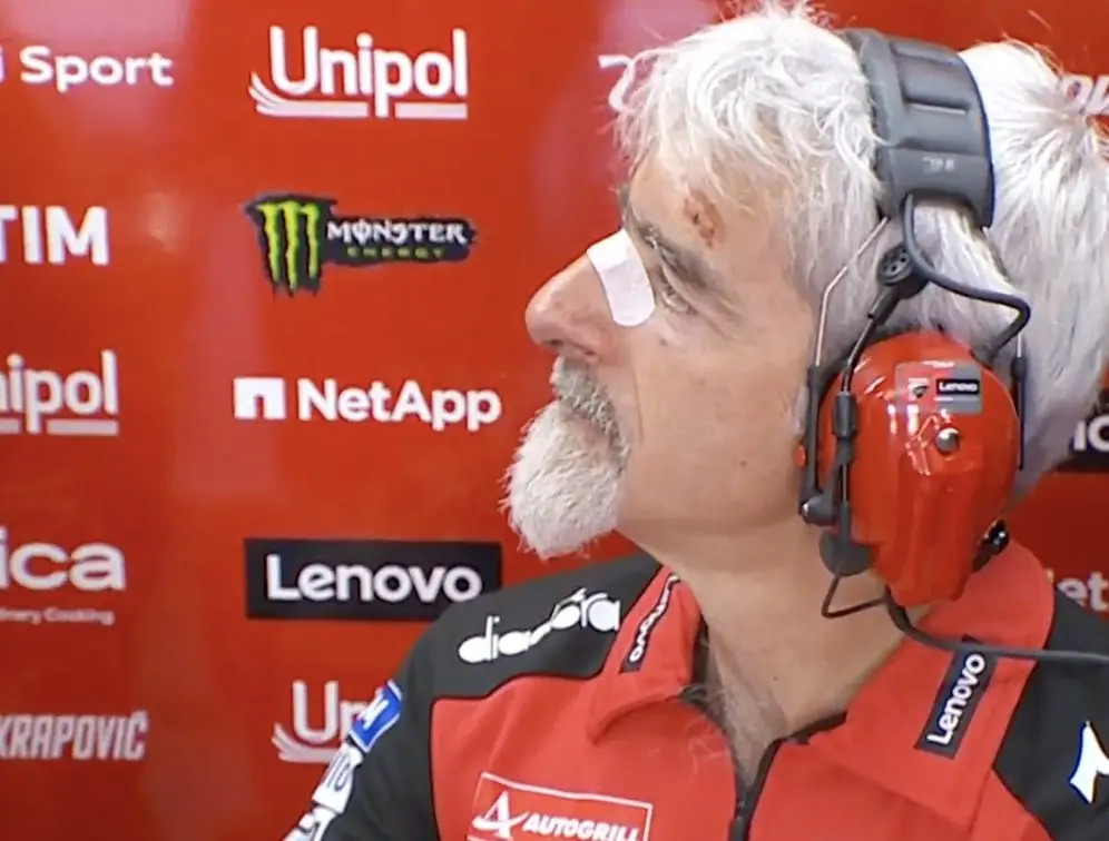 Gigi Dall'Igna 